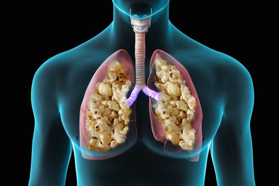 A animation of the literal meaning of Popcorn Lung.
